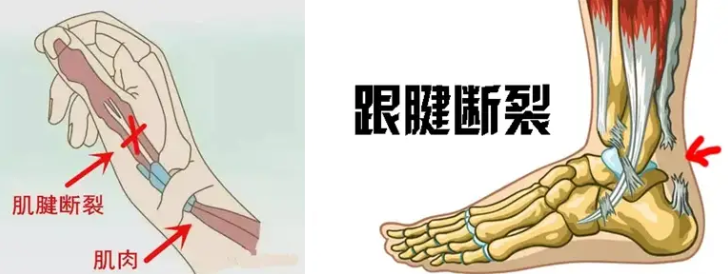 邵阳创伤骨科,邵阳风湿病区,邵阳骨质增生,邵阳关节病区,邵阳颈椎病区