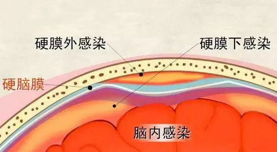 邵阳创伤骨科,邵阳风湿病区,邵阳骨质增生,邵阳关节病区,邵阳颈椎病区